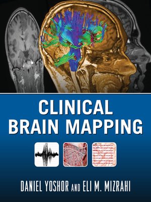 cover image of Clinical Brain Mapping